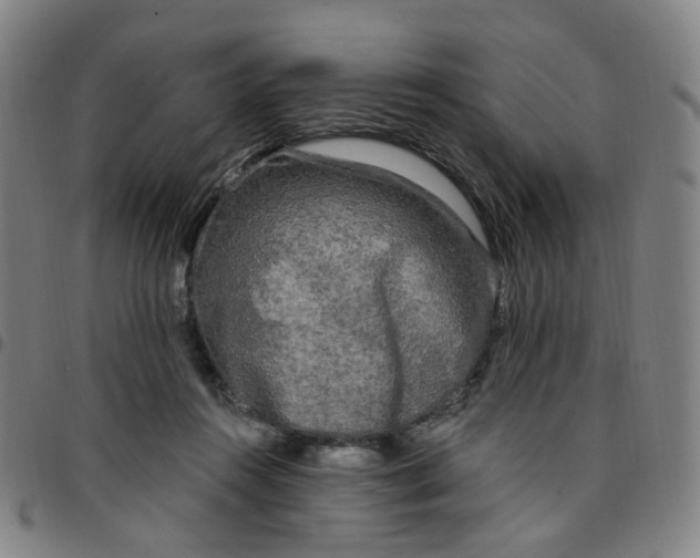 X0000097510360200803071830