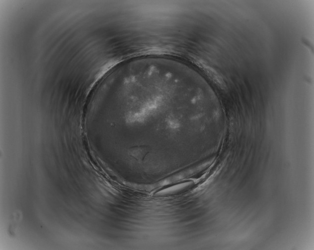 X0000097511170200803071818