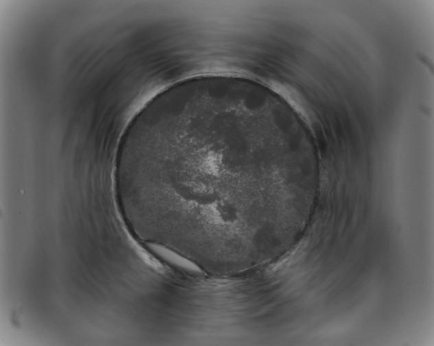 X0000097511237200803071817