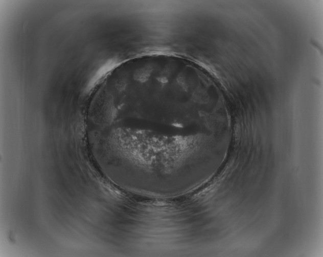 X0000097511359200803071815