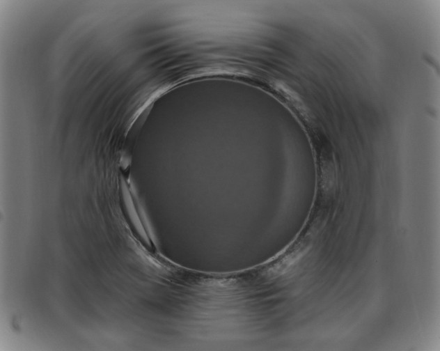 X0000097511369200803071815