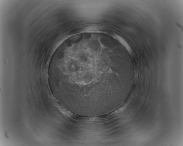 X0000097511435200803071814