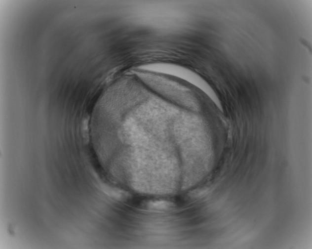 X0000097510360200803142046