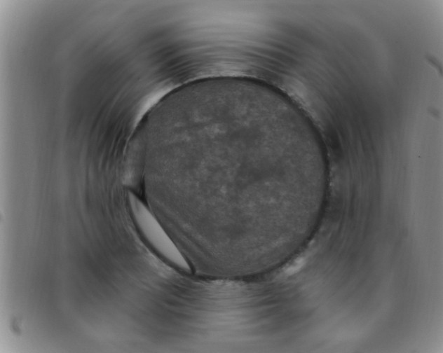 X0000097511081200803142036