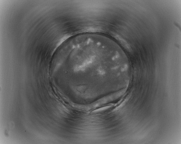 X0000097511170200803142034