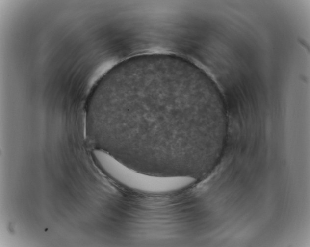 X0000097511171200803142034