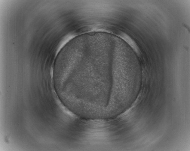 X0000097511198200803142034