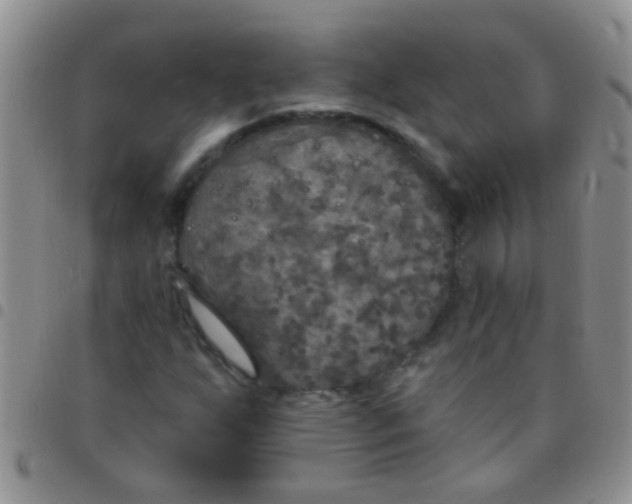 X0000097511255200803142033