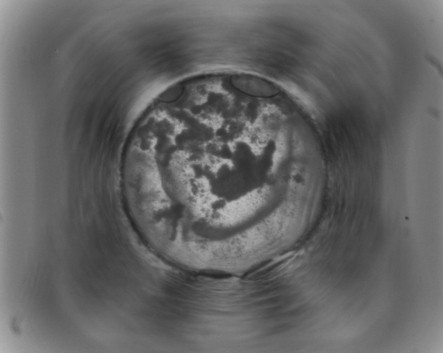 X0000097511279200803142033