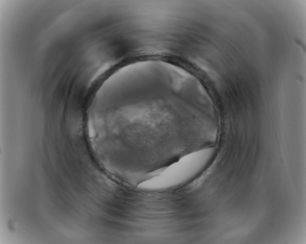 X0000097511306200803142032