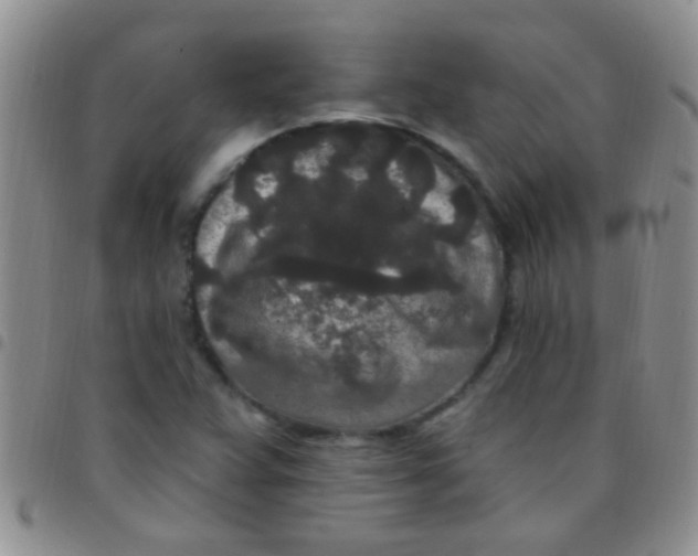 X0000097511359200803142032