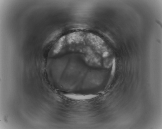 X0000097511399200803142031