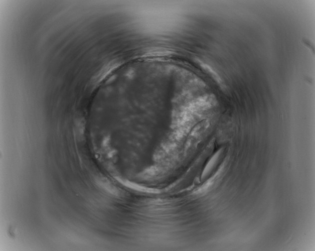 X0000097511401200803142031