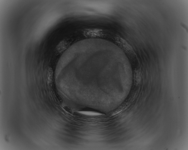 X0000097510760200803201615