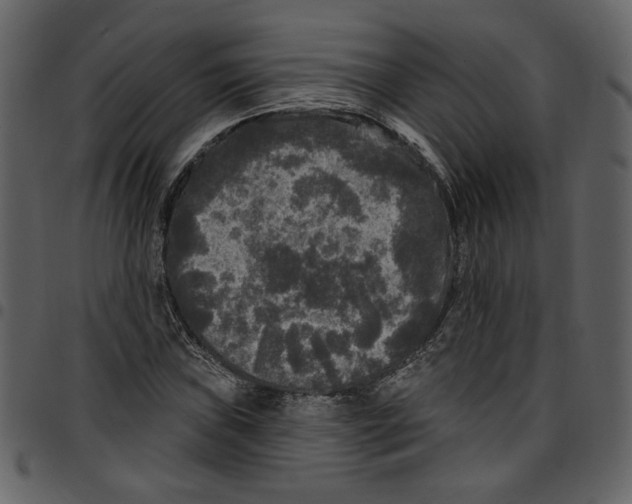 X0000097511019200803201611