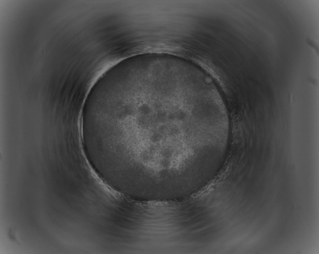 X0000097511032200803201611