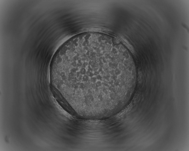 X0000097511036200803201611