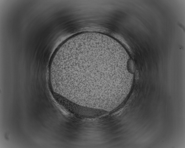 X0000097511040200803201611
