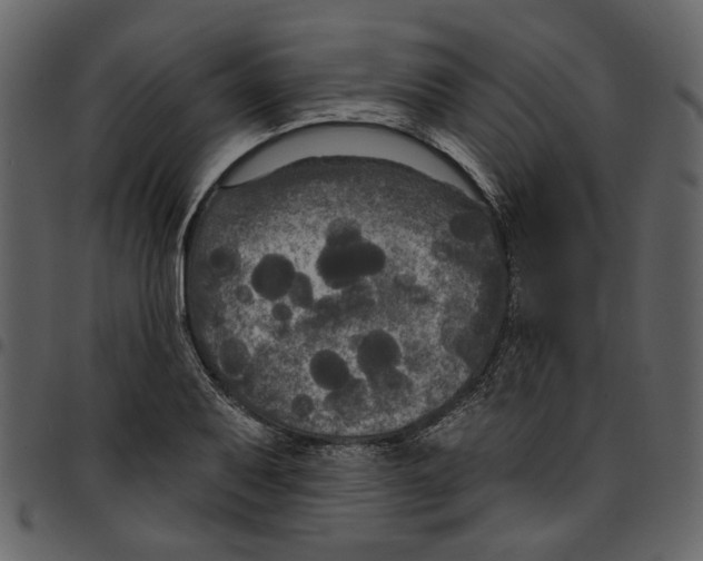 X0000097511079200803201610