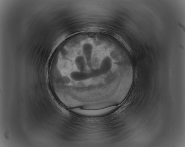 X0000097511083200803201610