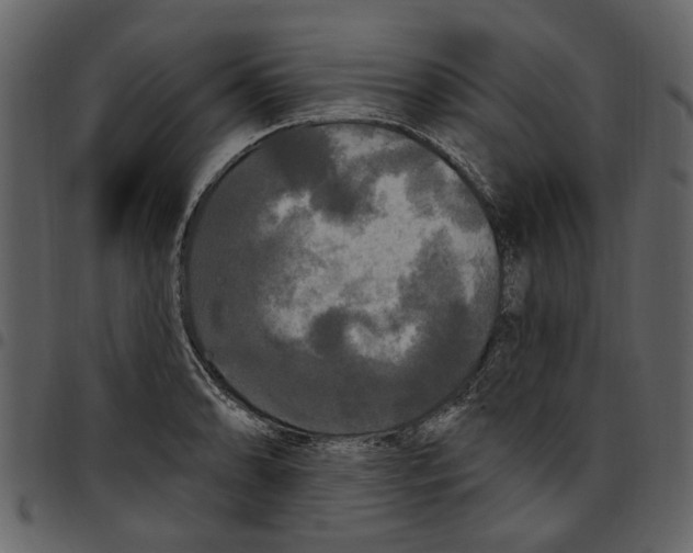 X0000097511086200803201610