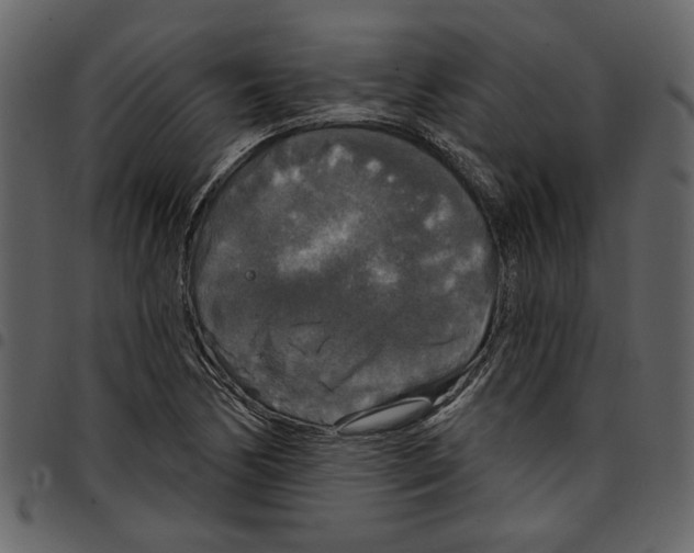 X0000097511170200803201609