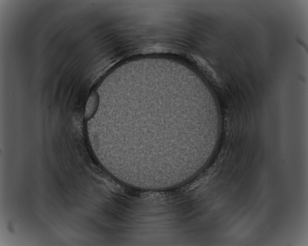 X0000097511217200803201608