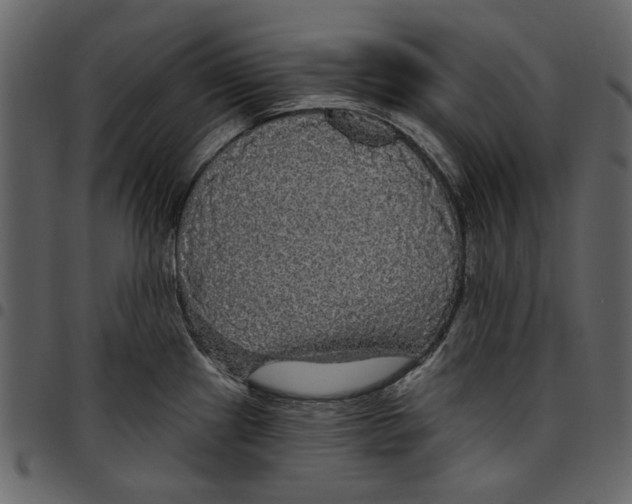 X0000097511241200803201608
