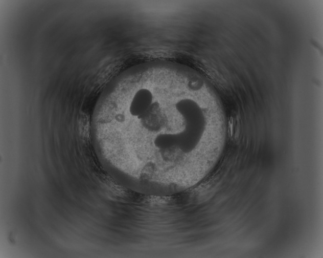X0000097511251200803201607