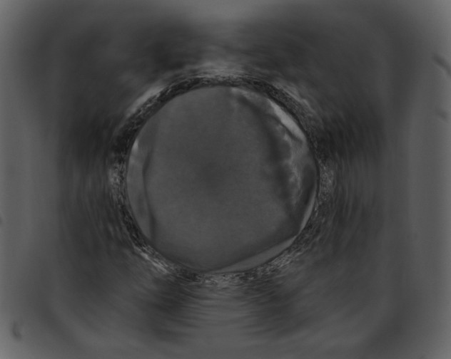X0000097511254200803201607