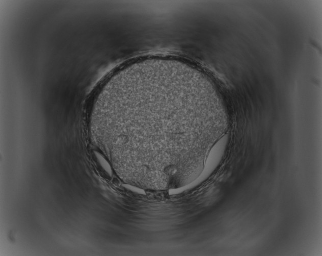 X0000097511256200803201607