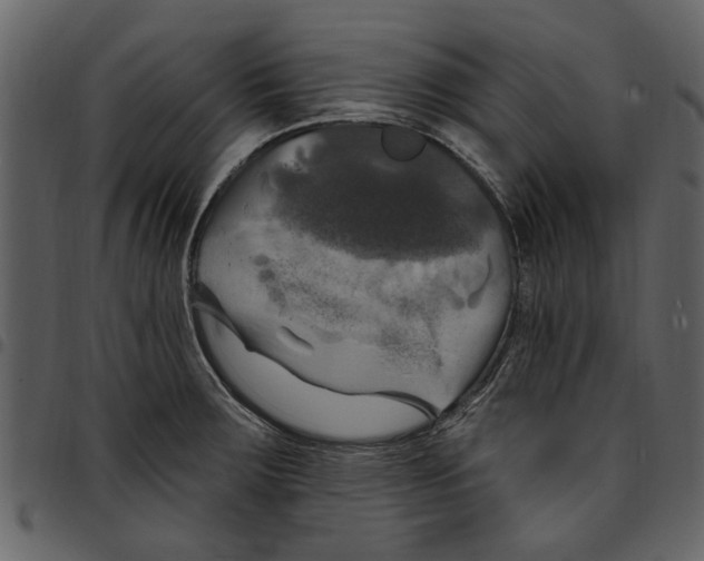 X0000097511283200803201607
