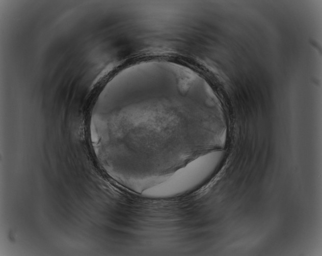 X0000097511306200803201606