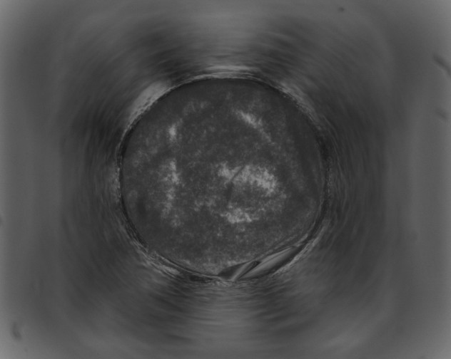 X0000097511362200803201606