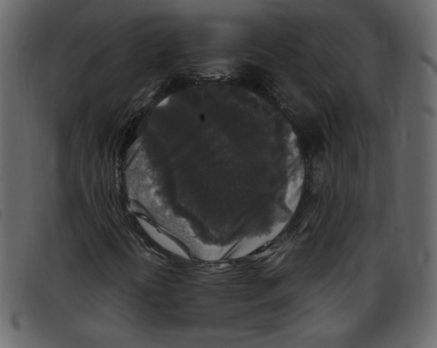 X0000097511394200803201605
