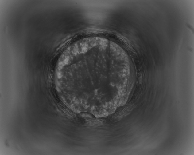 X0000097511397200803201605