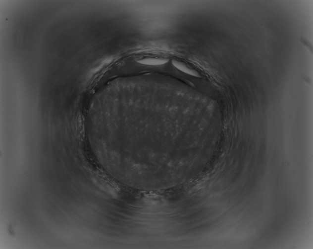 X0000097511398200803201605