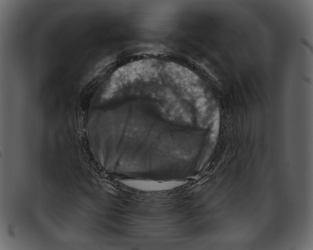 X0000097511399200803201605