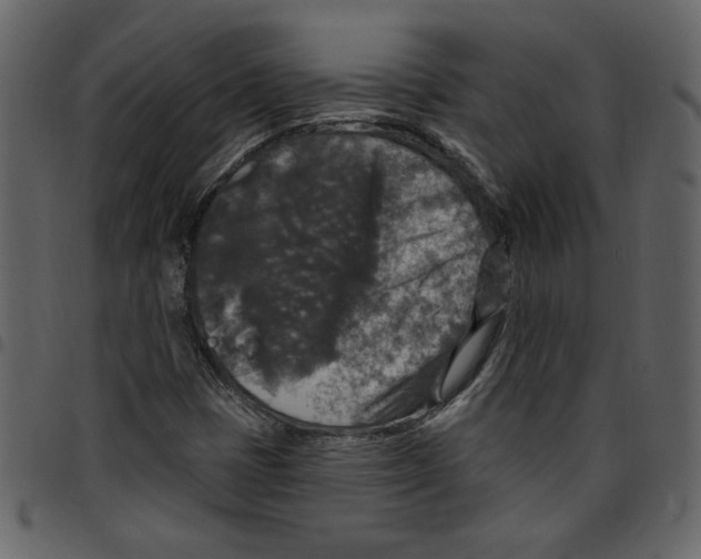 X0000097511401200803201605