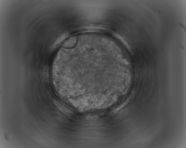 X0000097511403200803201605