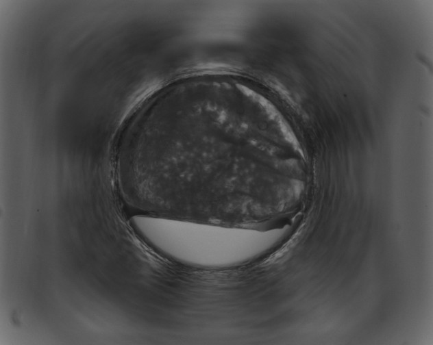 X0000097511405200803201605