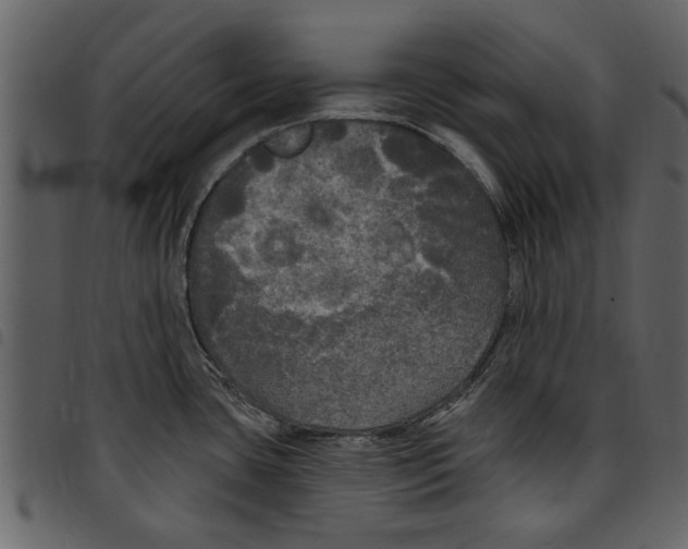 X0000097511435200803201605