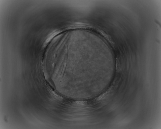 X0000097511453200803201604