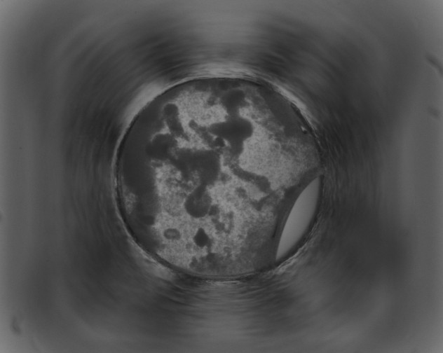 X0000097511471200803201604