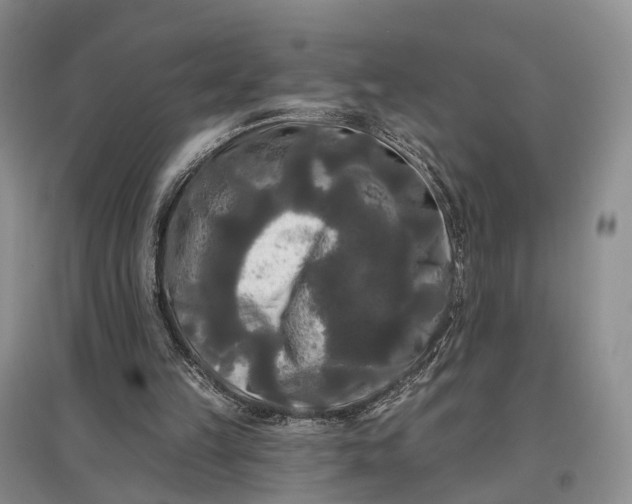 X0000097590149200803141902