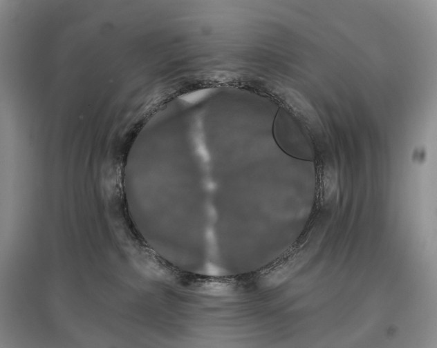 X0000097590236200803141901