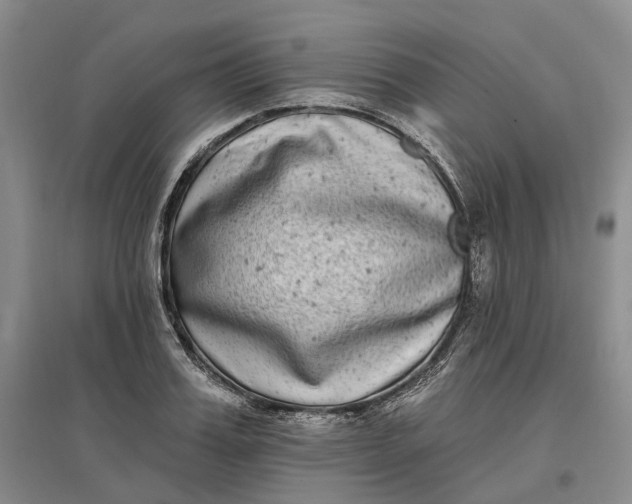 X0000097590987200803141851