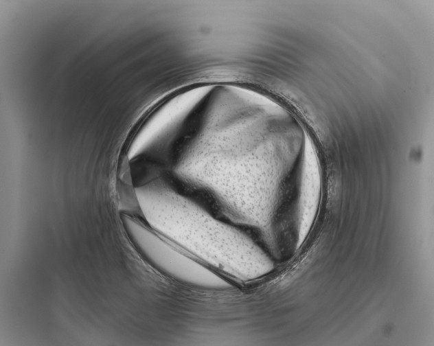 X0000097591465200803211625