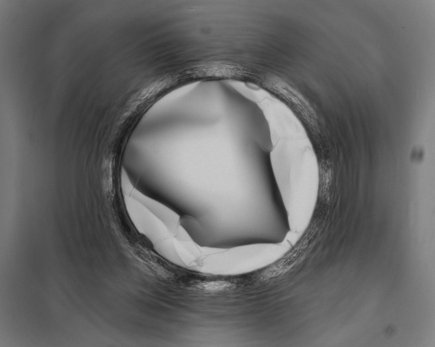 X0000097590158200803280936