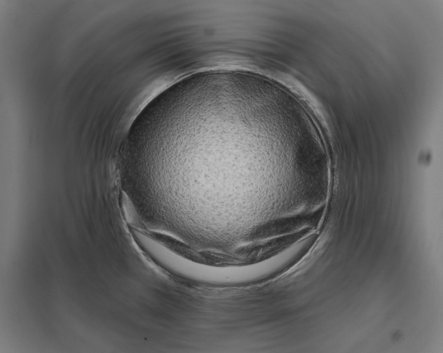 X0000097591385200803280917